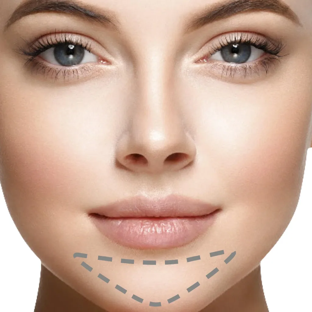 Gesichtshaarentferner Roxy Perfect Brows