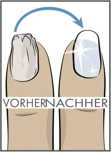 Nagelhärter mit Diamantpulver „Beauty Comfort“, 10 ml
