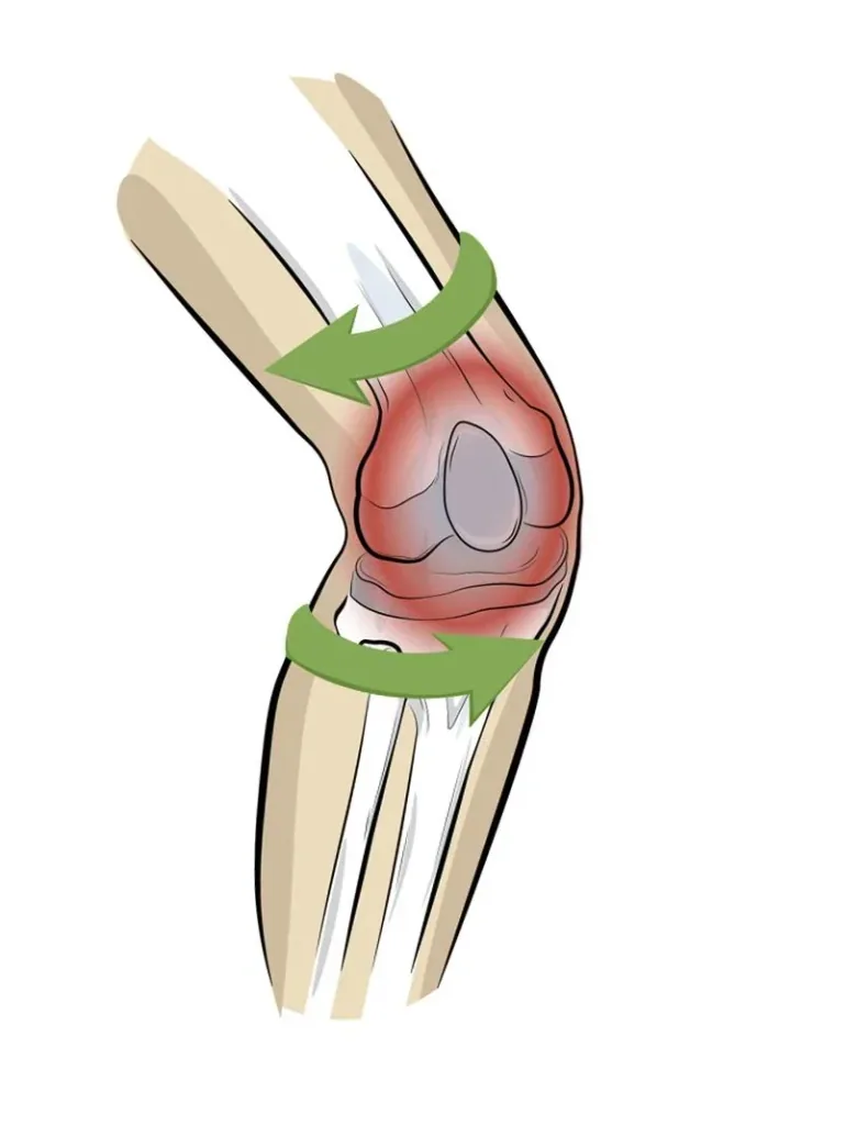 Kniebandage PatellaTec, Größe XXL