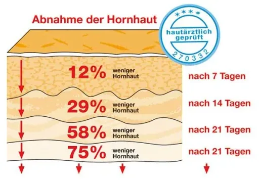 Hornhaut-Balsam, 30 ml