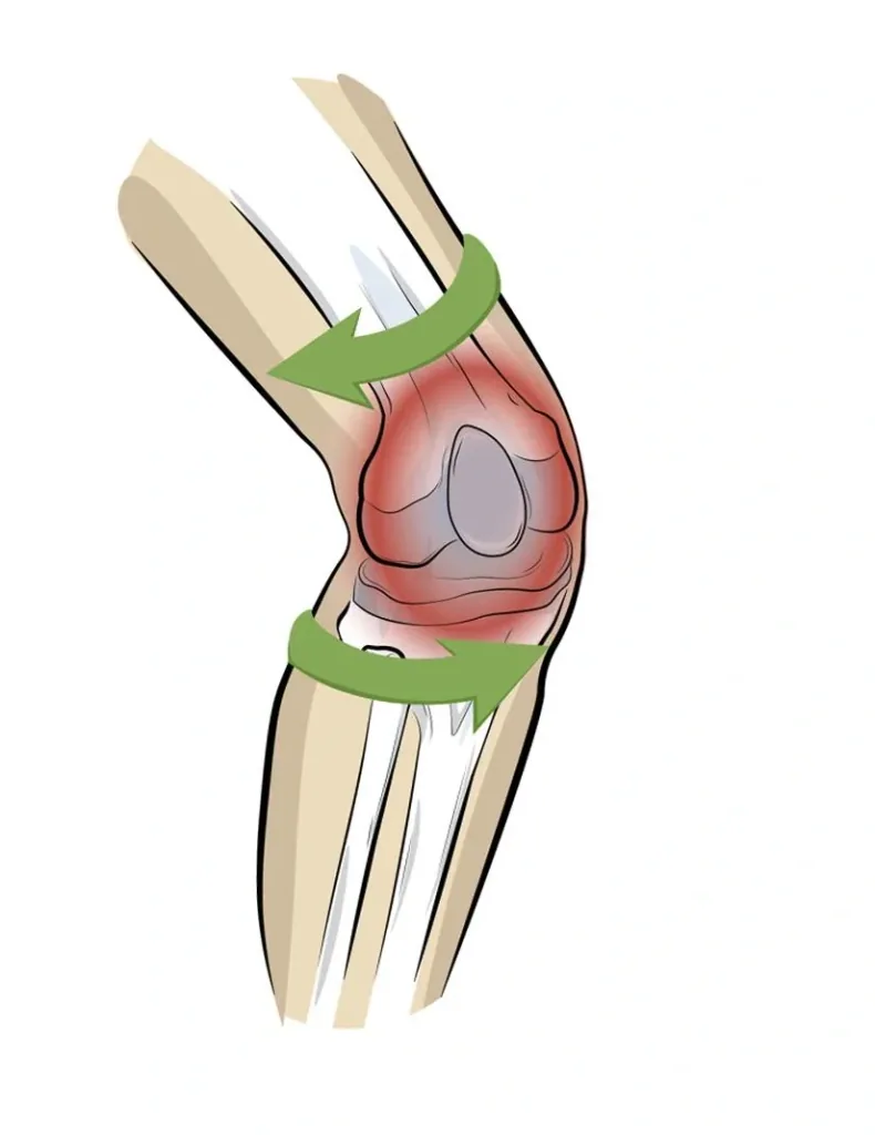 Kniebandage PatellaTec, Größe L